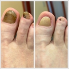 Smith Medical Pedicures