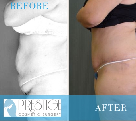 Prestige Cosmetic Surgery - New Braunfels, TX