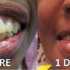 Advanced Oral Surgery of Tampa gallery