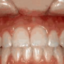 Marsh Orthodontics - William F Marsh DDS