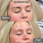 Liv Med Spa | Sioux Falls, SD