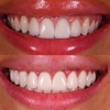 Chandler Dentistry gallery