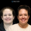 Smile Now Colorado Springs Dentures and Implants gallery