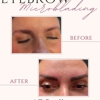 Arizona Studio of Electrolysis & Permanent Makeup gallery