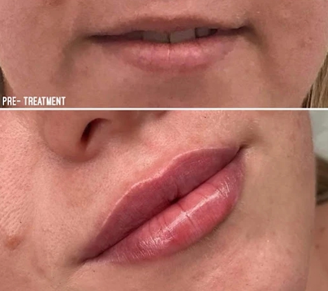 BeautyFULL Cosmetic Medical Clinic - Kingscliff, NSW