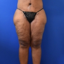 Ruston Sanchez, MD Plastic Surgery - Physicians & Surgeons, Plastic & Reconstructive