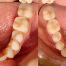 Orchard Dental Care - Implant Dentistry