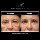 Asaadi Plastic Surgery