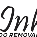 Uninked Laser Tattoo Removal - Tattoo Removal