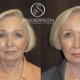 Texas Plastic Surgery Associates, PA