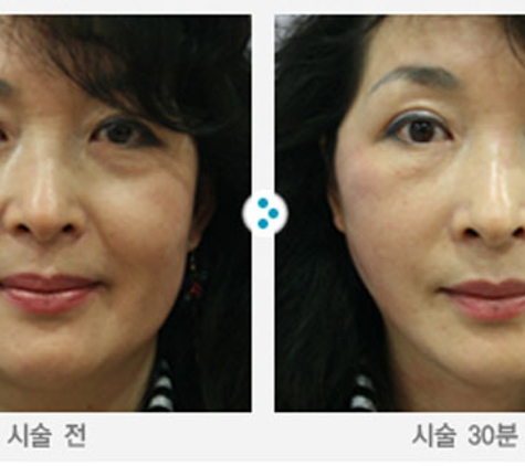 Jj Miracle Plastic Surgery Center - Arcadia, CA