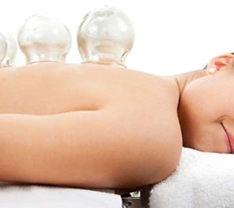 Awakening Balance Acupuncture - Northglenn, CO. Therapeutic Cupping