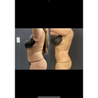 Grace MedSpa & Body Solutions