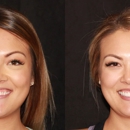 Intermountain Smiles - Implant Dentistry