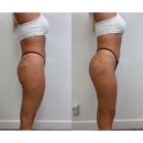 Toxwell Med Spa and Wellness - Medical Clinics