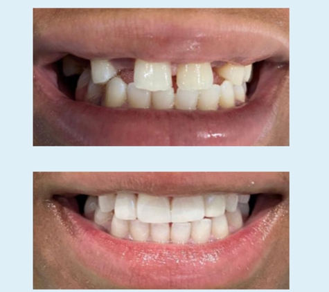 JC Dental Care - Houston, TX