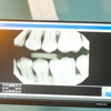 Gentle Dental Coal Creek gallery