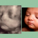 Chubby Cheeks 3D/4D Ultrasound Studio of Dallas - Medical Imaging Services