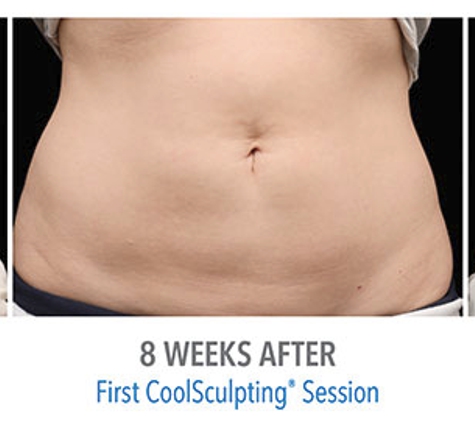 Sacramento Bariatric Medical Associates - Sacramento, CA. This location offers CoolSculpting