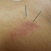 Laurel County Physiatry and Pain gallery