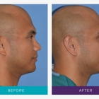 Trillium Aesthetic Facial Surgery