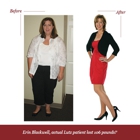 Medi-Weightloss Clinics of Lutz