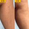 Metro Vein Centers | Buffalo gallery