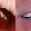 Today's Dental Care - Dental Hygienists