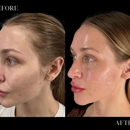 CosMedics Medical Aesthetic Clinic - Fenton - Medical Spas
