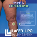 Laser Lipo and Vein Center - Physicians & Surgeons, Laser Surgery