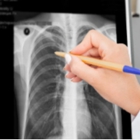 RAVE Imaging