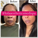 Lola Aesthetics & Medi Spa - Day Spas