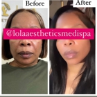 Lola Aesthetics & Medi Spa