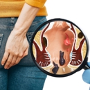 USA Hemorrhoid Centers - Harlem - Medical Clinics