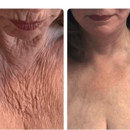 Dr. George Brennan - Cosmetic Surgeon Newport Beach - Physicians & Surgeons, Cosmetic Surgery