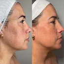 TS Browshes Esthetics and Laser - Hair Removal