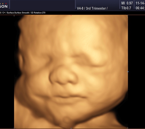 Heavenly 3d 4d Ultrasounds - Baldwin Park, CA