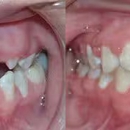Cherry Orthodontics - Teeth Whitening Products & Services