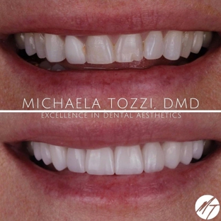 Dr. Michaela Tozzi, DMD: Cosmetic Dentistry & Dental Aesthetics - Henderson, NV