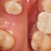 Summit Family Dental Care gallery