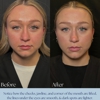 Hollywood Body & Face Denver/Metro gallery