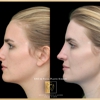 Ednan Mushtaq, MD Facial Surgery & Aesthetics gallery