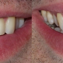 Broadlands Family Dentistry - Implant Dentistry