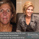 Synergy MedAesthetics - Kennewick - Hair Removal