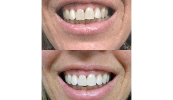 Bytes Dental Lismore - Goonellabah, NSW. Tooth whitenin