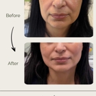 Permaskin Med Spa & Laser