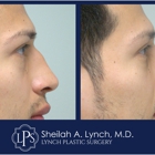 Sheilah A. Lynch, MD - Lynch Plastic Surgery