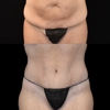 SynergyMD Plastic Surgery gallery