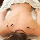 Orlando Holistic Acupuncture - Acupuncture