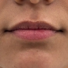 Novae Medical Aesthetics gallery